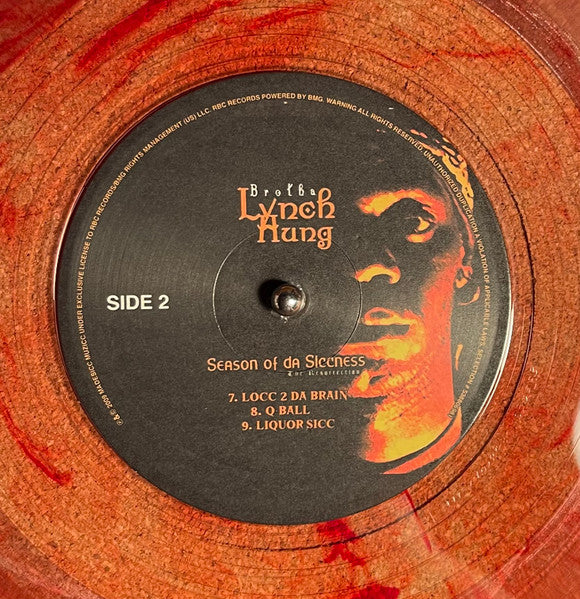 25156201
